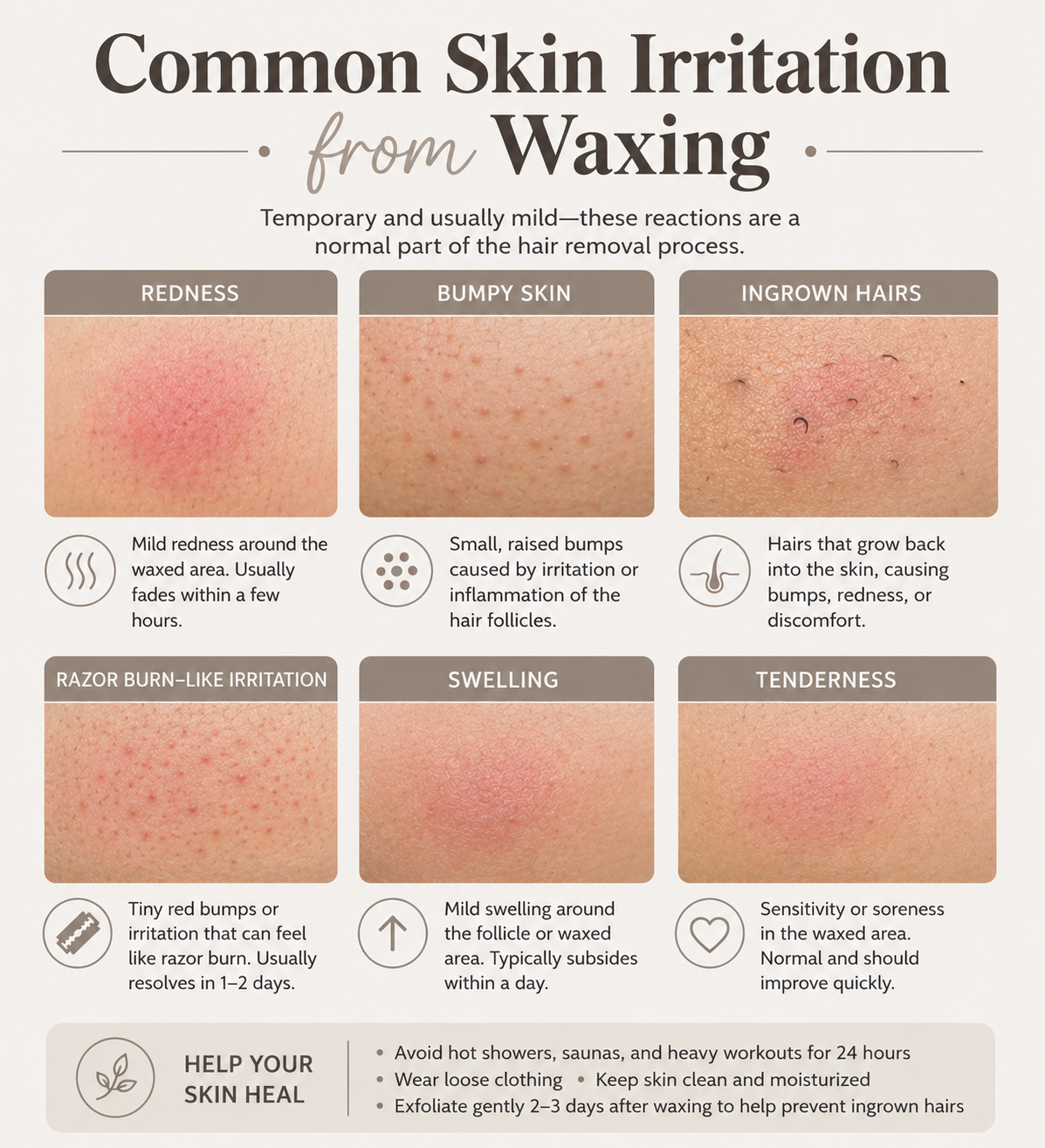 Common skin irritation after waxing may include redness, bumps, ingrown hairs, swelling, and temporary tenderness. These reactions are usually mild and short-lived, often improving within hours to a few days.